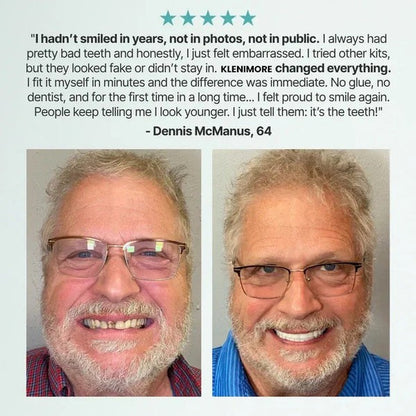 Flaresia™ ComfortFit Dentures